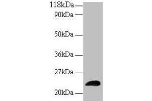 Western blot All lanes: LCN2 antibody at 2 μg/mL + Human positive serum Secondary Goat polyclonal to rabbit IgG at 1/15000 dilution Predicted band size: 23 kDa Observed band size: 23 kDa (Lipocalin 2 antibody  (AA 1-198))