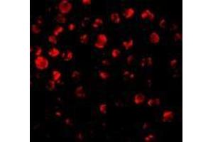 Immunofluorescence of IRAK2 in HeLa cells with AP30441PU-N IRAK antibody at 10 μg/ml. (IRAK2 antibody  (C-Term))