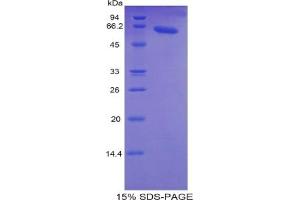 SDS-PAGE of Protein Standard from the Kit  (Highly purified E. (TNNC2 ELISA Kit)
