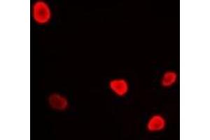 Immunofluorescent analysis of RFC4 staining in U2OS cells. (RFC4 antibody)