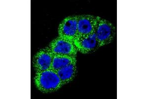 Confocal immunofluorescent analysis of IGF1R Antibody (N-term K66) (ABIN652374 and ABIN2841778) with WiDr cell followed by Alexa Fluor 488-conjugated goat anti-rabbit lgG (green).