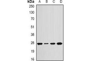 Western blot analysis of APC10 expression in Jurkat (A), mouse lung (B), mouse spleen (C), rat heart (D) whole cell lysates. (ANAPC10 antibody)