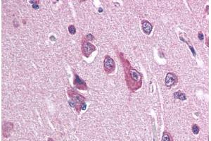 Human Brain, Cortex (formalin-fixed, paraffin-embedded) stained with SCN2B antibody ABIN337345 at 10-20 ug/ml followed by biotinylated goat anti-rabbit IgG secondary antibody ABIN481713, alkaline phosphatase-streptavidin and chromogen. (SCN2B antibody  (N-Term))