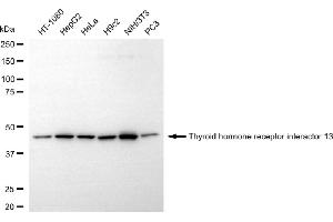 Western blotting analysis using thyroid hormone receptor interactor 13 antibody (ABIN7800555).