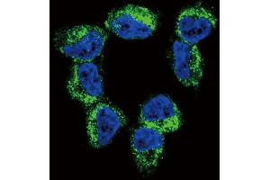 Confocal immunofluorescent analysis of BDNF Antibody (C-term) (ABIN392515 and ABIN2842076) with NCI- cell followed by Alexa Fluor 488-conjugated goat anti-rabbit lgG (green). (BDNF antibody  (C-Term))