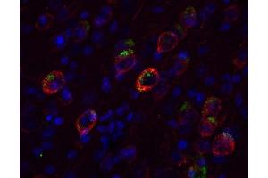 Immunostaining of a PFA fixed formic acid treated brain section from an triple transgenic Alzheimer mouse with anti-APP (dilution 1 : 200; red) and biotinylated mouse anti-Abeta (ABIN1742439BT, dilution 1 : 200, green).