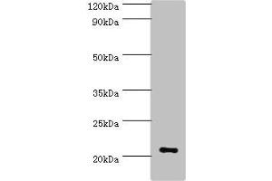 Western blot All lanes: ARF3 antibody at 6 μg/mL + Mouse brain tissue Secondary Goat polyclonal to rabbit IgG at 1/10000 dilution Predicted band size: 21, 17 kDa Observed band size: 21 kDa (ARF3 antibody  (AA 1-181))