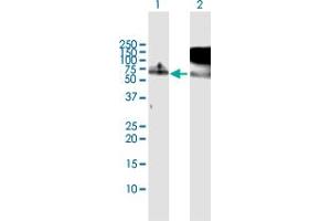 Western Blot analysis of RBM5 expression in transfected 293T cell line by RBM5 MaxPab polyclonal antibody. (RBM5 antibody  (AA 1-546))