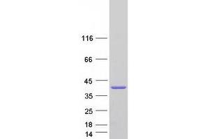 Validation with Western Blot (PARVG Protein (Transcript Variant 2) (Myc-DYKDDDDK Tag))
