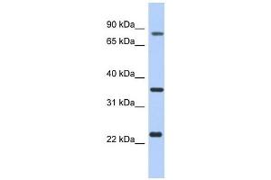 C17ORF82 antibody used at 1 ug/ml to detect target protein. (C17orf82 antibody  (N-Term))