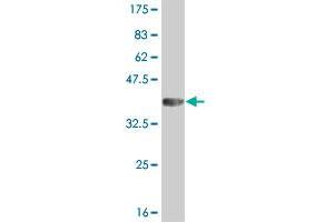 Western Blot detection against Immunogen (36. (IRAK2 antibody  (AA 111-210))