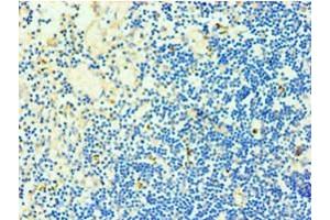 Immunohistochemistry of paraffin-embedded human thymus tissue using ABIN7173325 at dilution of 1:100 (TCOF1 antibody  (AA 1189-1488))