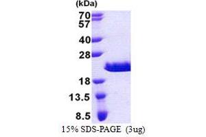 SDS-PAGE (SDS) image for RPA Interacting Protein (RPAIN) (AA 1-106) protein (His tag) (ABIN5853173) (RPAIN Protein (AA 1-106) (His tag))