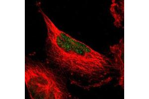 Immunofluorescent staining of U-251 MG with MINA polyclonal antibody  (Green) shows positivity in nucleus. (MINA antibody)