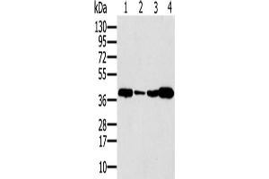 Gel: 12 % SDS-PAGE, Lysate: 40 μg, Lane 1-4: Human testis tissue, Human seminoma tissue, Jurkat cells, human liver cancer tissue, Primary antibody: ABIN7192710(SYCP3 Antibody) at dilution 1/200, Secondary antibody: Goat anti rabbit IgG at 1/8000 dilution, Exposure time: 40 seconds (SYCP3 antibody)