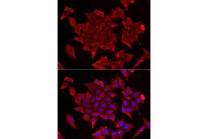 Immunofluorescence analysis of U2OS cells using TIMM17A antibody. (TIMM17A antibody)