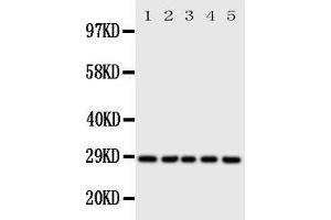 Western Blotting (WB) image for anti-Stratifin (SFN) (AA 140-156), (Middle Region) antibody (ABIN3044182) (14-3-3 sigma/SFN antibody  (Middle Region))