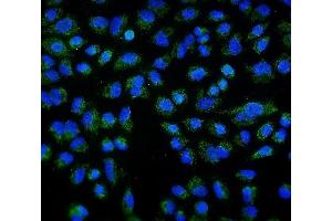 IF analysis of DLL1 using anti-DLL1 antibody (ABIN7600324).
