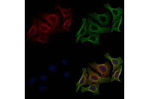 ABIN6256614 and ABIN6267490 staining HepG2 cells(4h of LPS treatment) by IF/ICC. (VEGFR2/CD309 antibody  (pTyr1059))