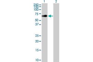 Western Blot analysis of ZIM2 expression in transfected 293T cell line by ZIM2 MaxPab polyclonal antibody. (ZIM2 antibody  (AA 1-527))