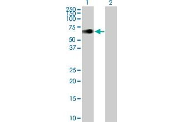 ZIM2 anticorps  (AA 1-527)