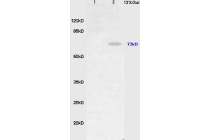 L1 mouse stomach lysates L2 mouse liver lysates probed with Anti HDC Polyclonal Antibody, Unconjugated (ABIN736986) at 1:200 in 4 °C. (HDC antibody  (AA 351-450))