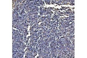 IHC analysis of Annexin VI/ANXA6 using anti-Annexin VI/ANXA6 antibody (ABIN5692982). (ANXA6 antibody  (AA 395-665))