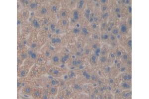 IHC-P analysis of liver tissue, with DAB staining. (CES1 antibody  (AA 31-286))