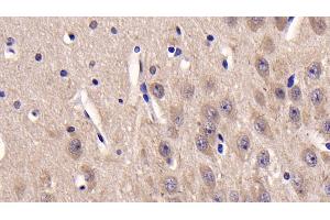 Detection of CSNK1d in Human Cerebrum Tissue using Monoclonal Antibody to Casein Kinase 1 Delta (CSNK1d) (Casein Kinase 1 delta antibody  (AA 1-409))