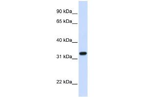 WB Suggested Anti-TBCB Antibody Titration: 0. (TBCB antibody  (C-Term))