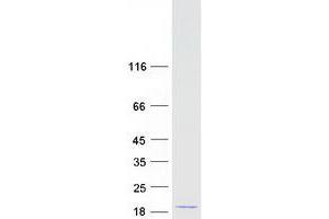 C2ORF76 Protein (Myc-DYKDDDDK Tag)