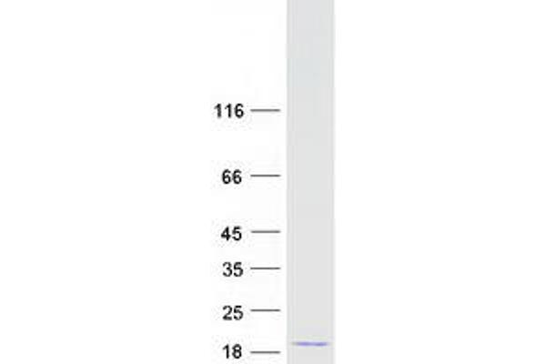 C2ORF76 Protein (Myc-DYKDDDDK Tag)