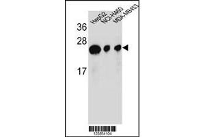 Western blot analysis in HepG2,NCI-H460,MDA-MB453 cell line lysates (35ug/lane). (ATP5H antibody  (AA 68-97))