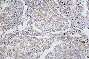 IHC analysis of ApoER2/LRP8 using anti-ApoER2/LRP8 antibody (ABIN7601752).