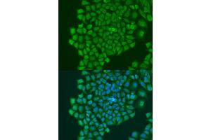 Western blot analysis of extracts of HepG2 cells, using YB-1/YB-1/YBX1 antibody (ABIN7271411) at 1:1000 dilution. (YBX1 antibody  (AA 100-200))