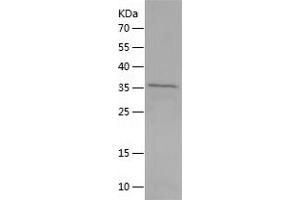 Western Blotting (WB) image for Musashi Homolog 2 (MSI2) (AA 1-328) protein (His tag) (ABIN7288308) (MSI2 Protein (AA 1-328) (His tag))