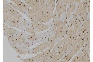 ABIN6277018 at 1/100 staining Mouse heart tissue by IHC-P. (MT2A antibody)