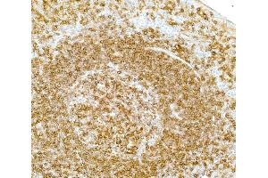 Immunohistochemistry (IHC) image for anti-MHC Class II HLA-DP/DQ/DR (HLA-DP/DQ/DR) antibody (ABIN7449429) (MHC Class II HLA-DP/DQ/DR antibody)