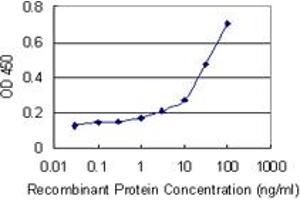 Detection limit for recombinant GST tagged UBR1 is 0. (UBR1 antibody  (AA 2-100))