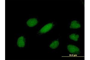 Immunofluorescence of purified MaxPab antibody to YEATS4 on HeLa cell. (GAS41 antibody  (AA 1-227))