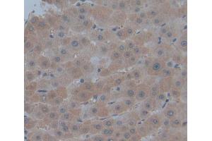 IHC-P analysis of Kidney tissue, with DAB staining. (PMM1 antibody  (AA 2-262))
