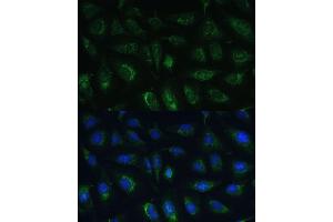 Immunofluorescence analysis of U-2 OS cells using R Polyclonal Antibody (ABIN7269849) at dilution of 1:100 (40x lens). (GRF2 antibody  (AA 844-1095))