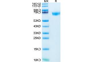 ROBO4 Protein (AA 28-480) (His tag)