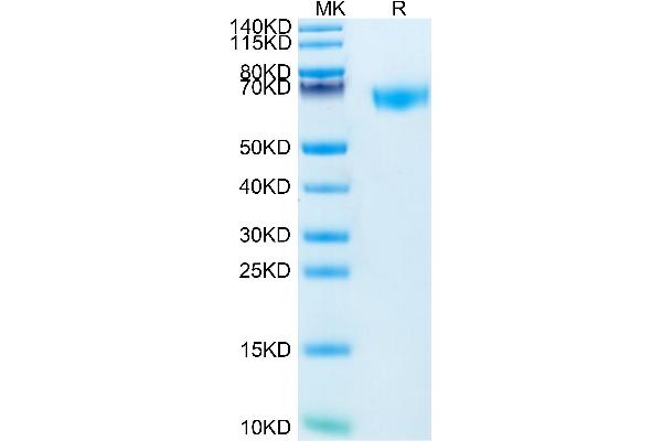 ROBO4 Protein (AA 28-480) (His tag)