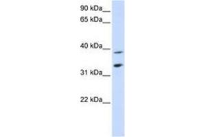 Image no. 1 for anti-Solute Carrier Family 25, Member 34 (SLC25A34) (C-Term) antibody (ABIN6740861)