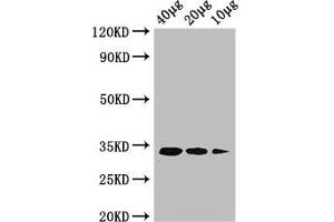 Western Blot Positive WB detected in: Rosseta bacteria lysate at 40 μg, 20 μg, 10 μg All lanes: ldcA antibody at 1 μg/mL Secondary Goat polyclonal to rabbit IgG at 1/50000 dilution predicted band size: 34 kDa observed band size: 34 kDa (LDCA (AA 1-304) antibody (Biotin))
