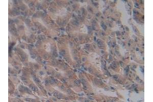 #VALUE! (ICOSLG antibody  (AA 58-249))