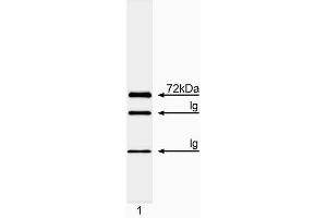 Immunoprecipitation/western blot analysis of Itk. (ITK antibody  (AA 1-26))