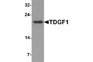 Western Blotting (WB) image for anti-Teratocarcinoma-Derived Growth Factor 1 (TDGF1) (N-Term) antibody (ABIN1077401) (TDGF1 antibody  (N-Term))