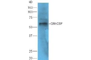 GM-CSF 抗体  (AA 65-144)